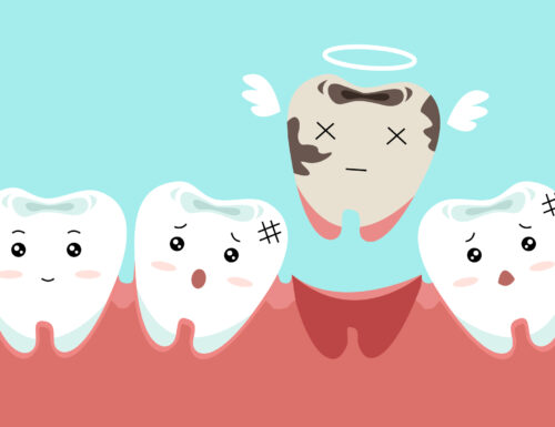 Sognare di perdere i denti porta male?